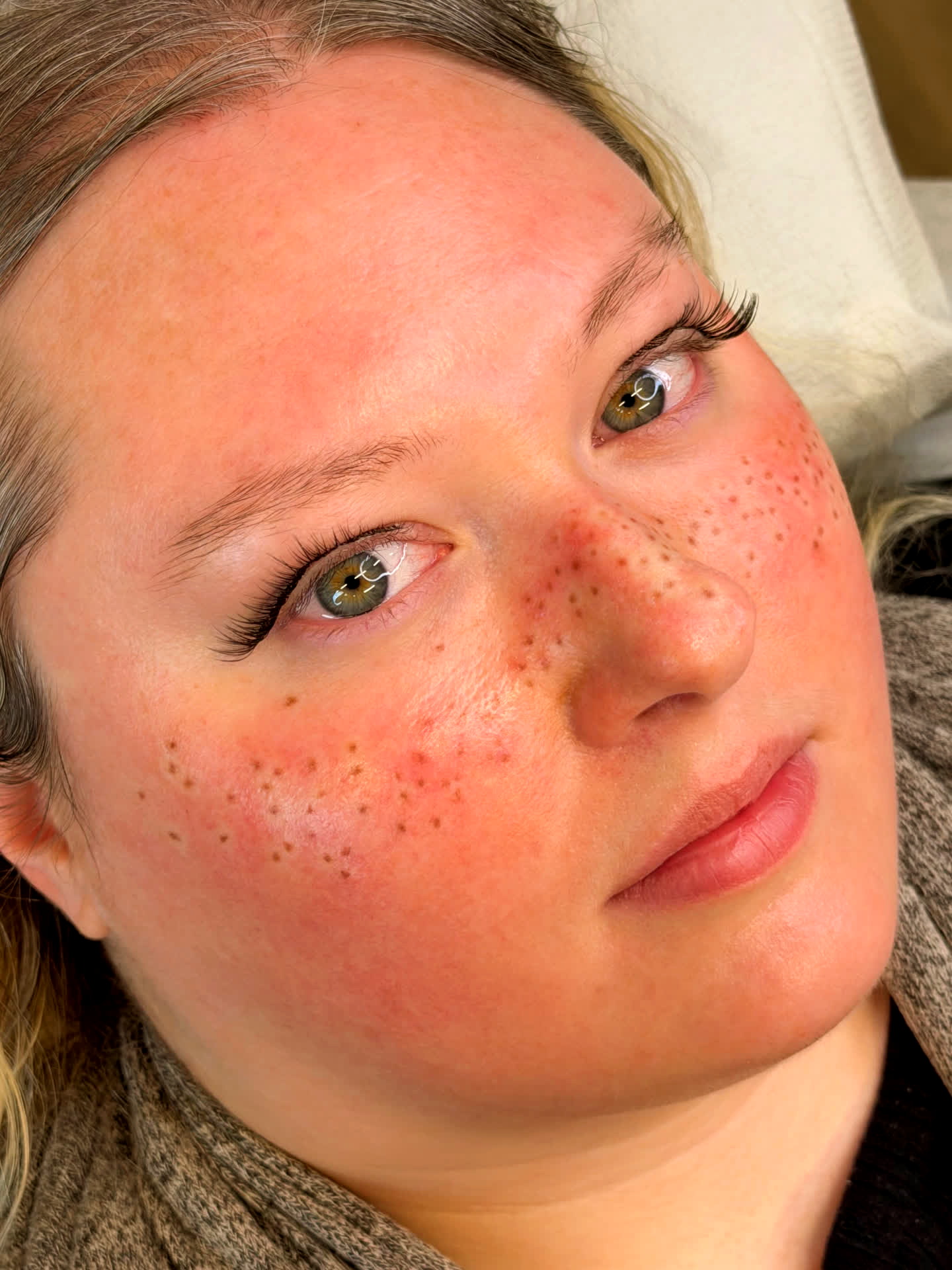 Faux freckles